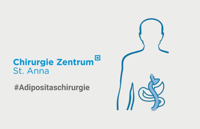 Warum Adipositas-OPs Leben retten können