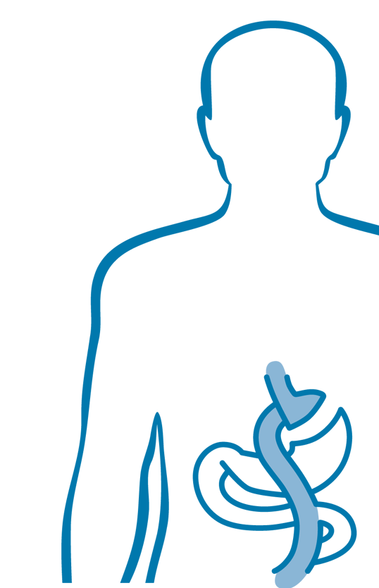 Adipositaschirurgie